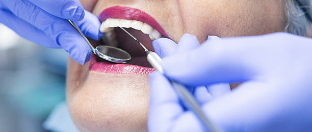 Best Emergency Broken Tooth Repair in Agler Estates, FL